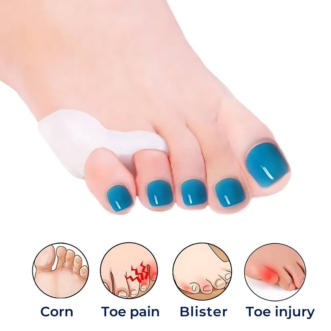 Orthopedische Teenspreiders voor Bunionette Correctie – Hallux Valgus Uitlijning – Little Toe Straightener – Hamertenen Preventie – Dagelijks Draagcomfort | Sulvida