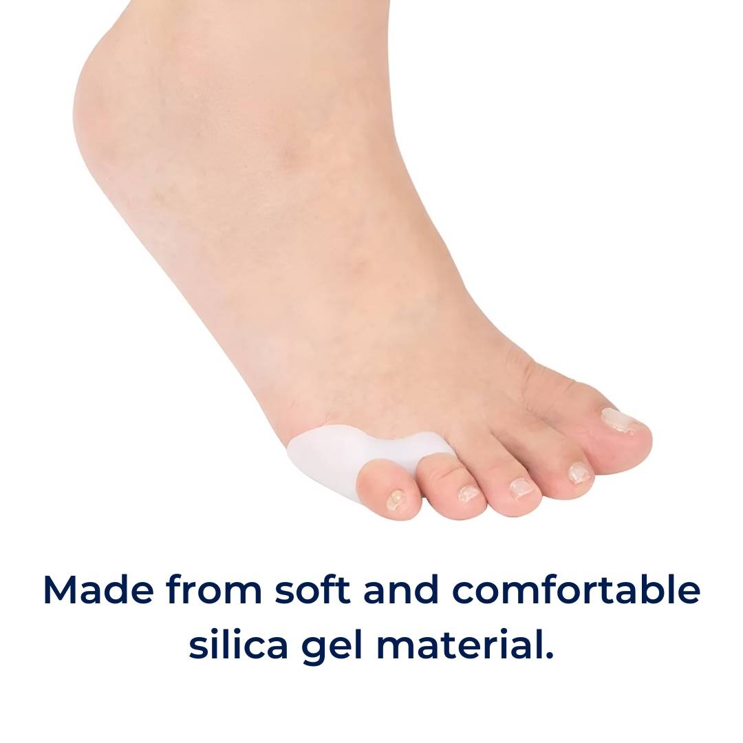 Orthopedische Teenspreider voor Bunionette en Hallux Valgus Correctie Kleintenen Comfortabel Rechtzetten | Sulvida