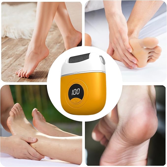 Elektrische Eeltverwijderaar Voetvijl Callus Remover met Roller voor Zachte Voeten Pedicure Thuis | Sulvida