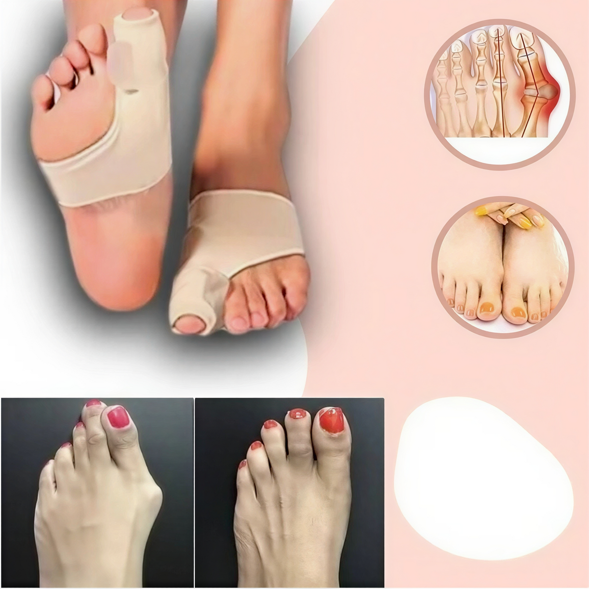 Hallux Valgus Correctiebrace Siliconen Teenspreiders Voetsteun Pijnverlichting Orthopedische Voetbraces | Sulvida