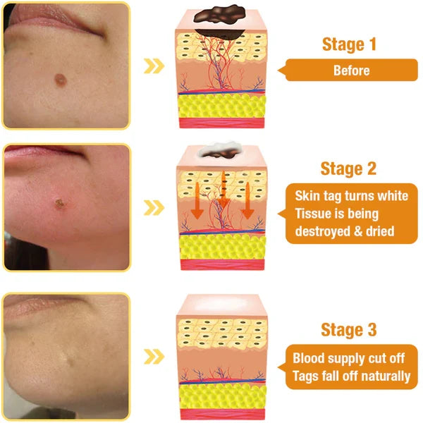 Huidlaesie Behandelspray met Natuurlijke Werkzame Stoffen 30 ml Intensieve Huidverzorging Spray Dermatologie | Sulvida