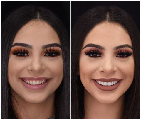 Snap-On Veneers Boventanden Ondertanden Natuurlijke Glimlach Verwijderbaar Pasvorm Kunstgebit Cosmetisch | Sulvida