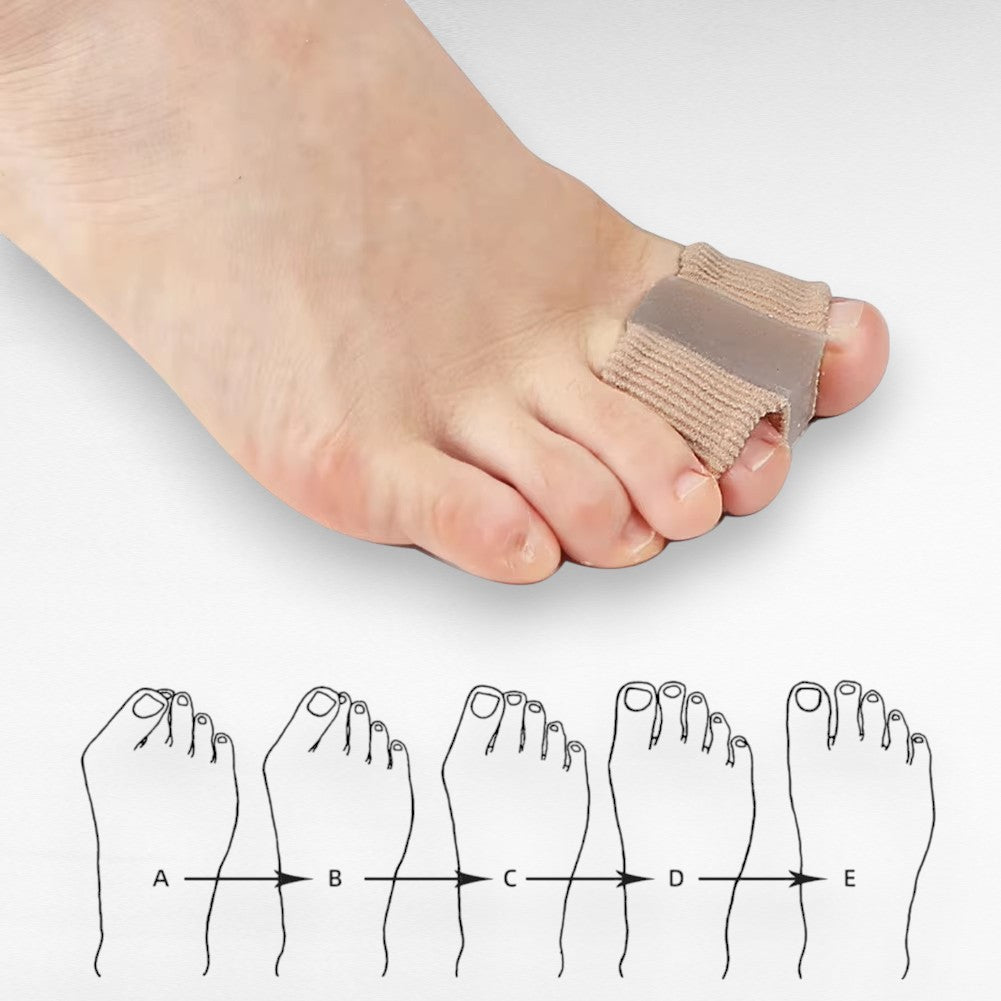 Teenspreider voor hallux valgus en overlappende tenen – comfortabel gel 1,5 cm teenspreiding beige (1 paar) | Sulvida