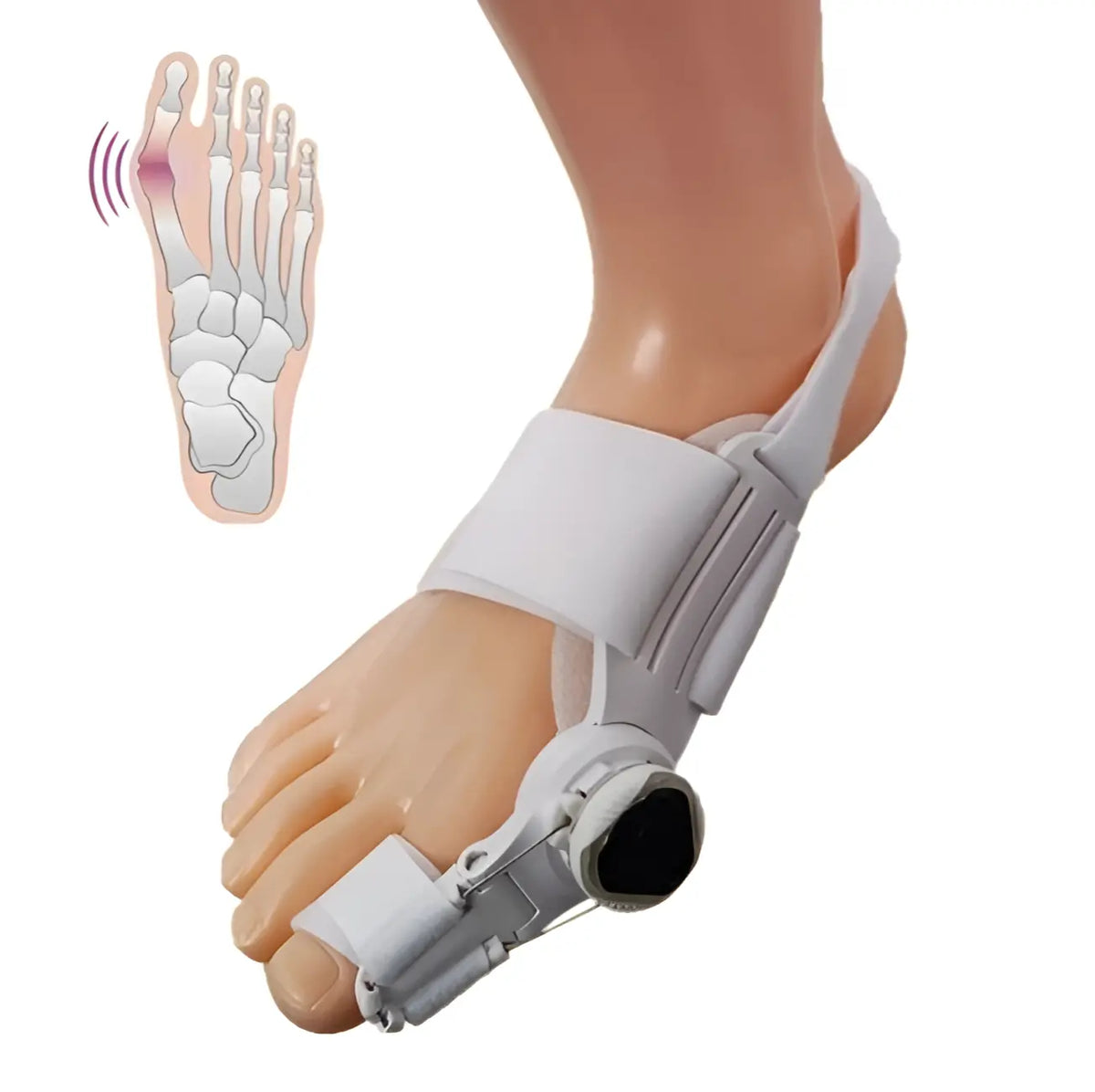 Orthopedische Teenbeugel Verstelbaar Hallux Valgus Correctie Nacht & Dag Draagbaar Pijnverlichting Comfortabel | Sulvida