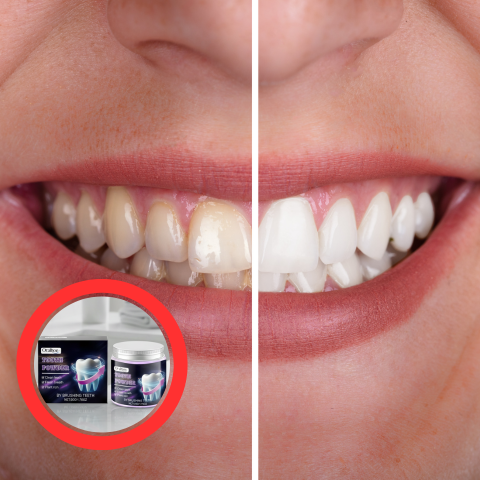 Tandbleekmiddel 5D Poeder met Frisse Adem – Helpt bij Vlekken & Krachtige Whitening Thuis Tandverzorging | Sulvida