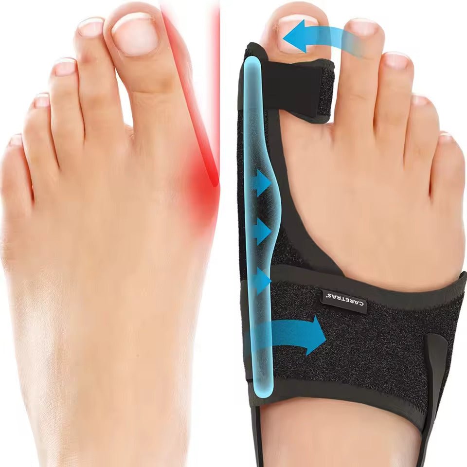 Nachtspalksysteem voor correctie hallux valgus met ergonomische pasvorm verstelbare band en comfortabel draaggemak | Sulvida