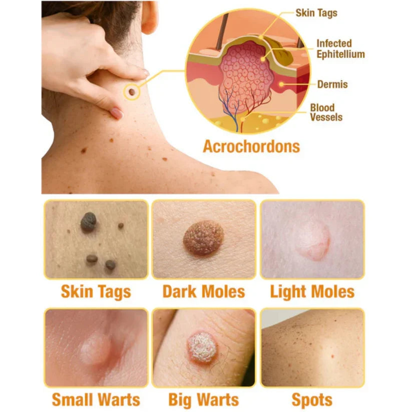 Huidlaesie Behandelspray met Natuurlijke Werkzame Stoffen 30 ml Intensieve Huidverzorging Spray Dermatologie | Sulvida