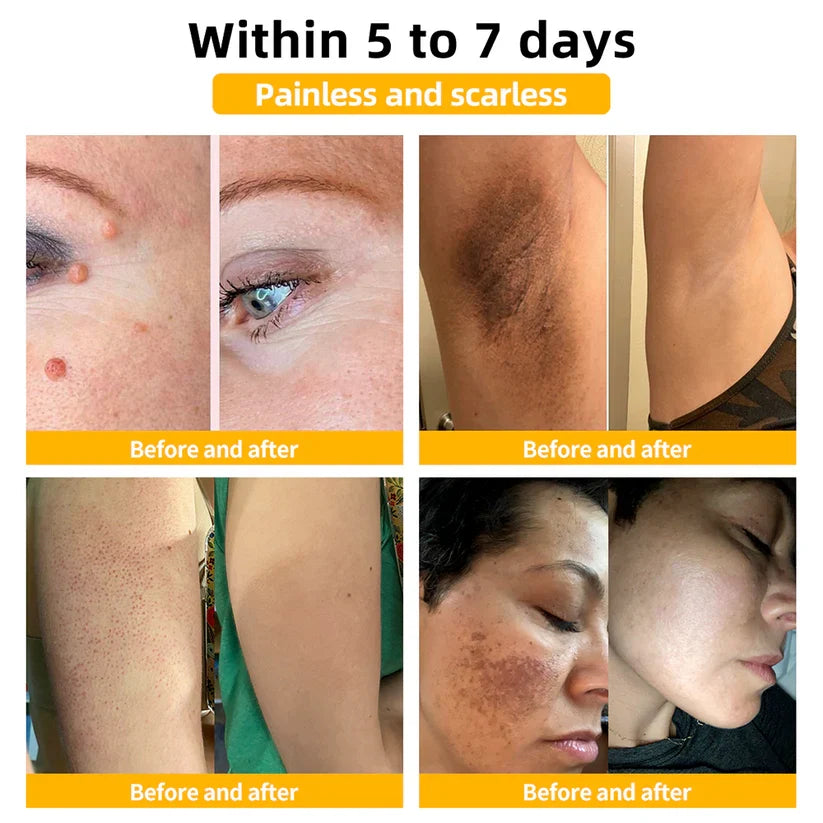Huidlaesie Behandelspray met Natuurlijke Werkzame Stoffen 30 ml Intensieve Huidverzorging Spray Dermatologie | Sulvida