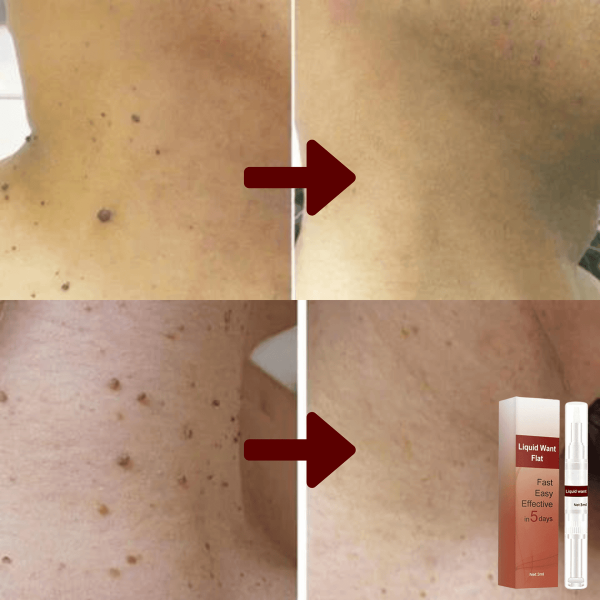 Huidoneffenheden Verwijderen Serum 3ml Verzorgingsrolstift Natuurlijk Huidverzorging Rimpelvermindering | Sulvida