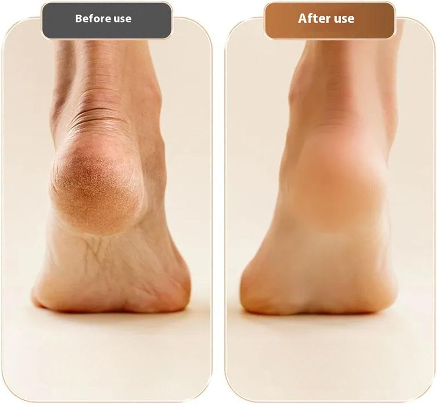Elektrische Eeltverwijderaar Voetvijl Callus Remover met Roller voor Zachte Voeten Pedicure Thuis | Sulvida