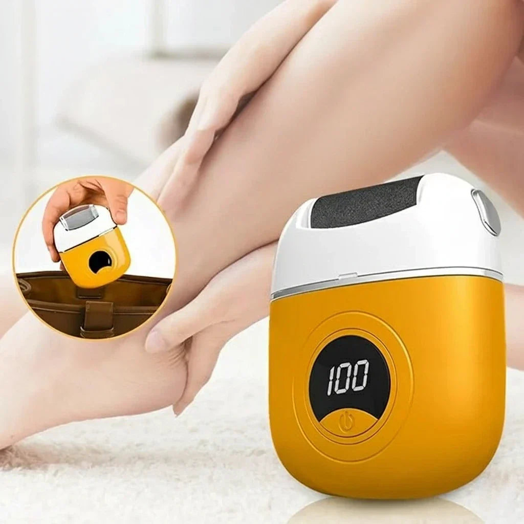 Elektrische Eeltverwijderaar Voetvijl Callus Remover met Roller voor Zachte Voeten Pedicure Thuis | Sulvida