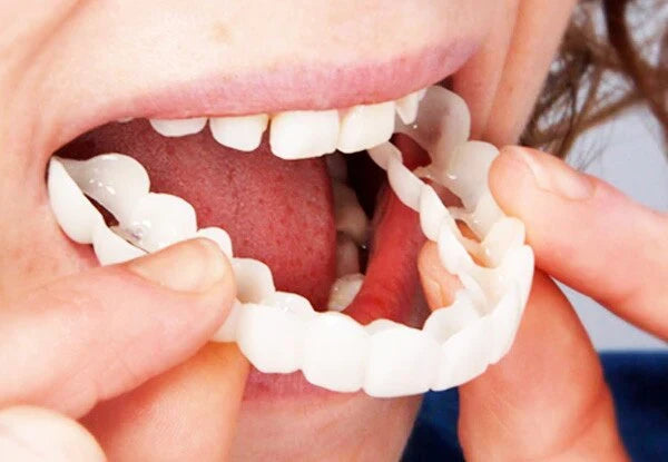 Cosmetisch Opzetgebit Tijdelijke Tanden Siliconen Flexibel Natuurlijk Wit Smile Protese Veneer Kunstgebit | Sulvida