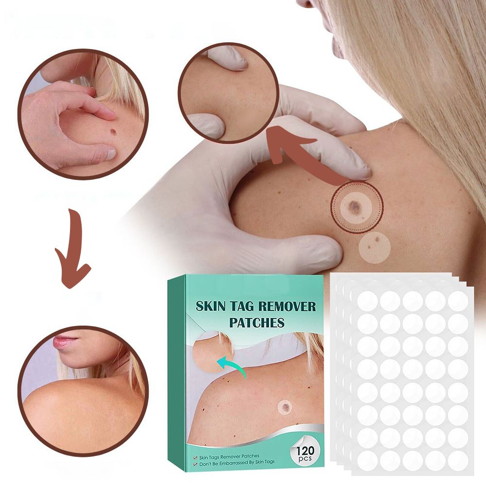 Huidvlekken- en wratten-verwijderpleisters met Hydrocolloïd – Pijnloos & Discreet – 120 Stuks | Sulvida