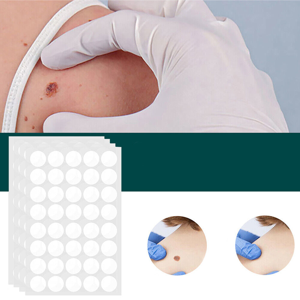 Huidvlekken- en wratten-verwijderpleisters met Hydrocolloïd – Pijnloos & Discreet – 120 Stuks | Sulvida