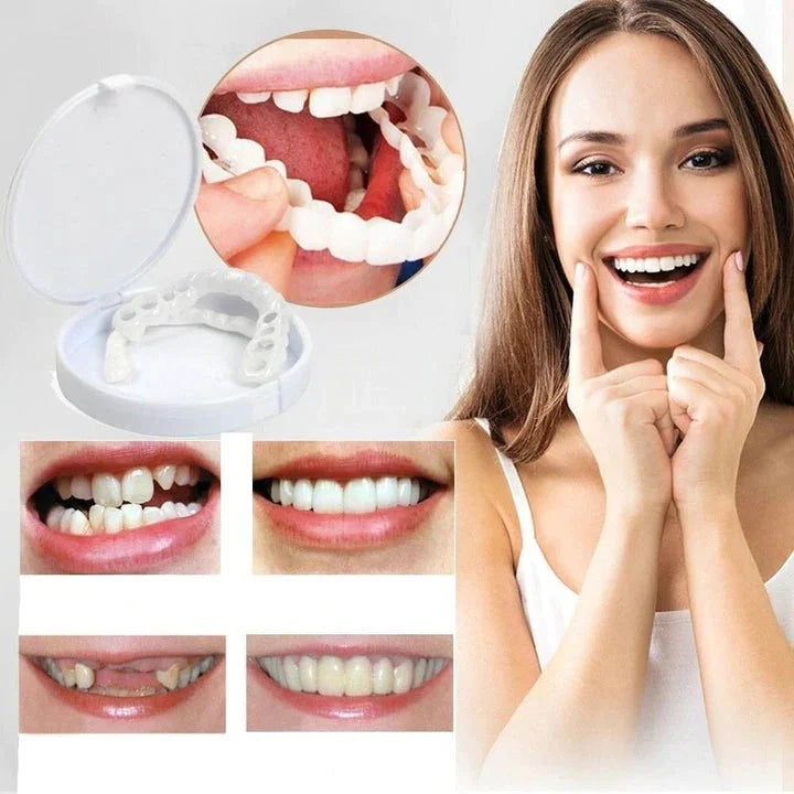Snap-On Veneers Boventanden Ondertanden Natuurlijke Glimlach Verwijderbaar Pasvorm Kunstgebit Cosmetisch | Sulvida