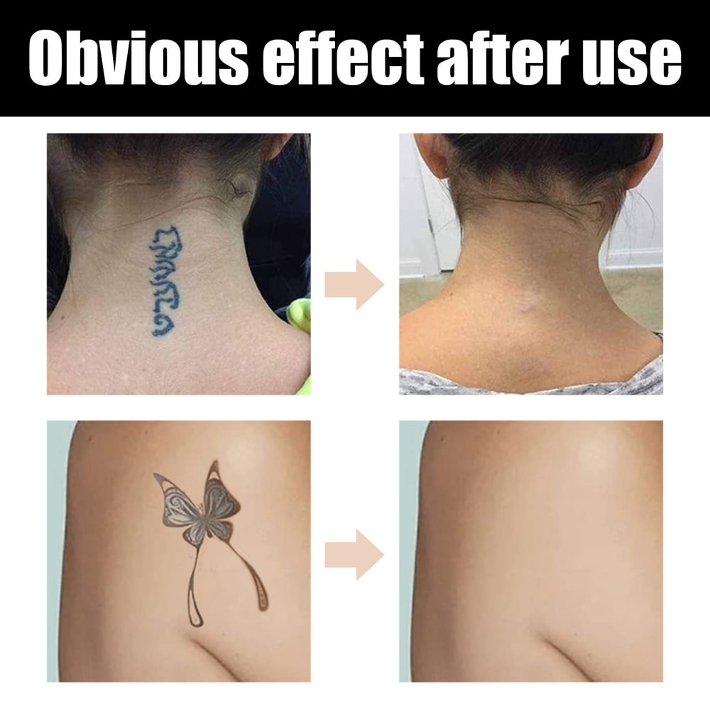 Waterdichte Dekkende Concealer voor Tatoeages Littekens en Oneffenheden 12 Uur Langdurig met Twee Tinten | Sulvida