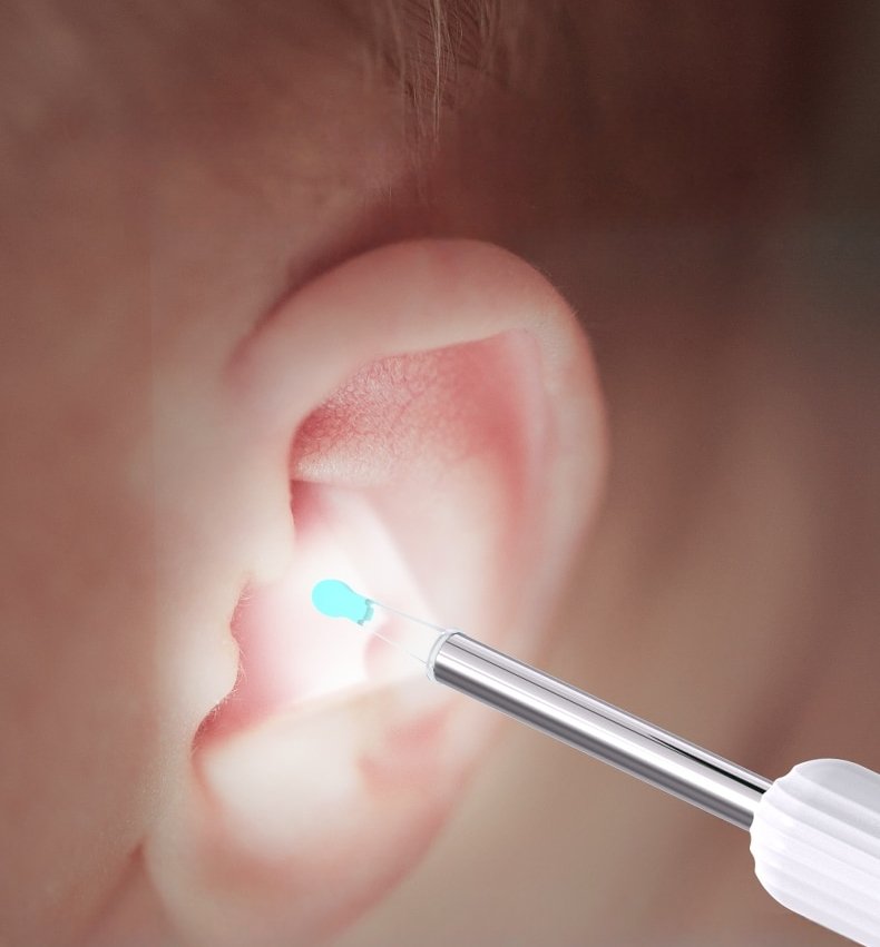 Oorspiegeltje met Camera en LED-Verlichting voor Thuis – Draadloze Oorreiniger met HD-Beeldscherm voor Veilige Oorhygiëne en Oorwasinspectie | Sulvida
