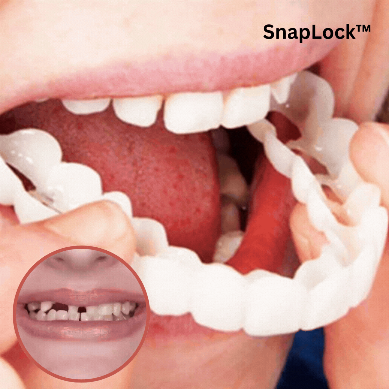 Kunstgebit Prothese Boven- en Ondertanden Instant Smile Veneers zonder Kleefpasta Cosmetische Tanden | Sulvida